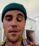 Hailey Bieber Justin Bieber Ramsay Hunt syndrome instagram video ig 730no