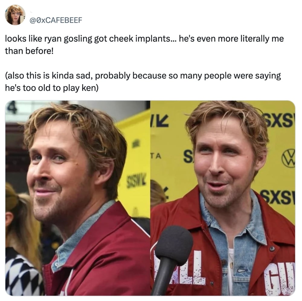 Ryan Gosling implants fake